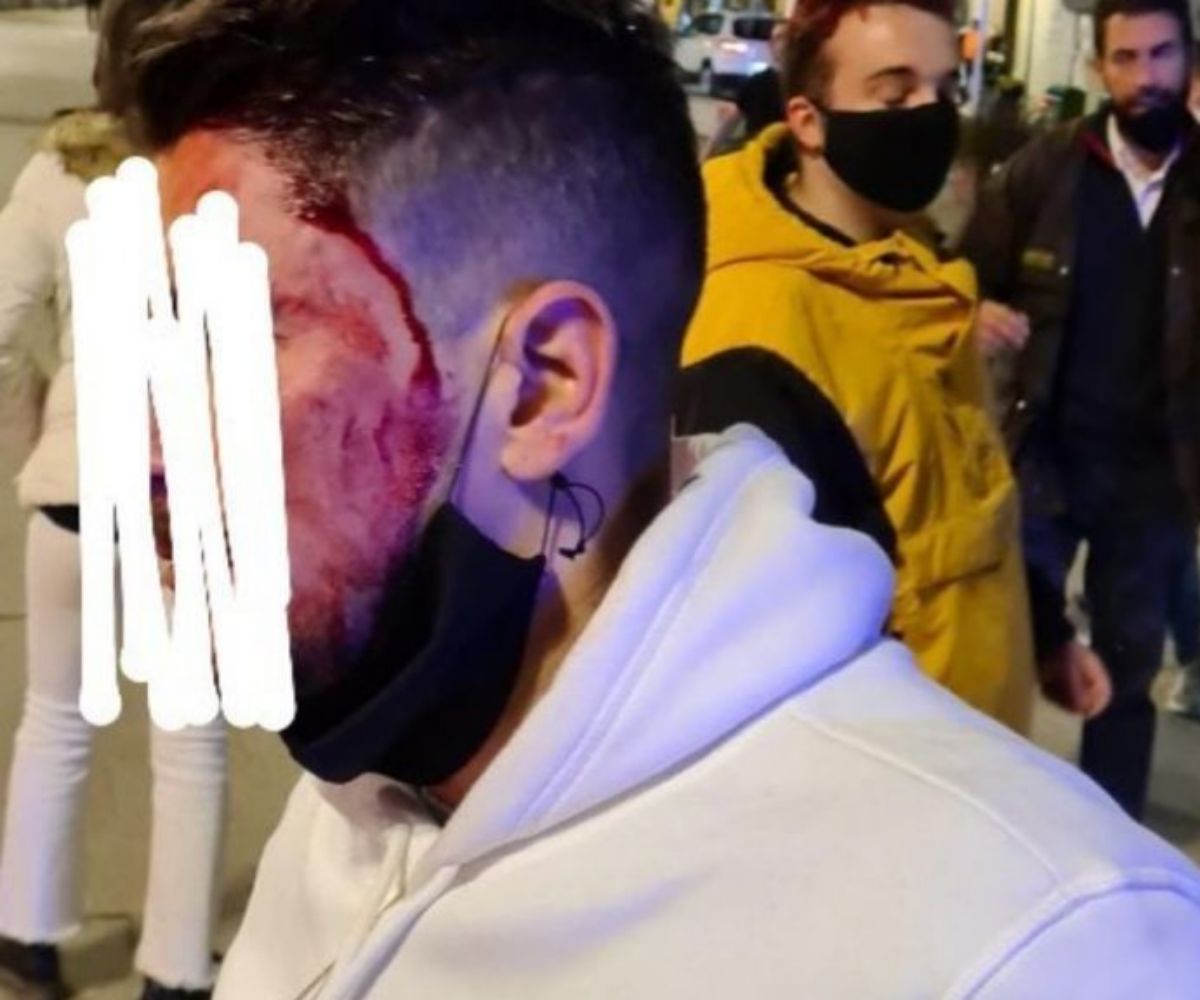 Vox denuncia un ataque en Vic con simpatizantes heridos y daños en la ...