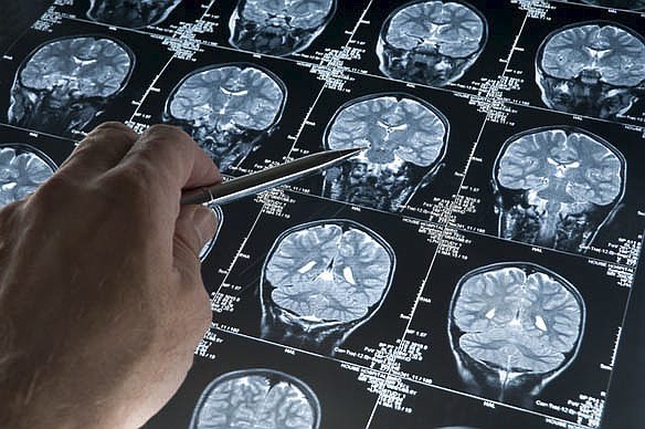 La importancia del criticoma: ventanas de plasticidad en las que "el cerebro absorbe como una esponja toda la información"