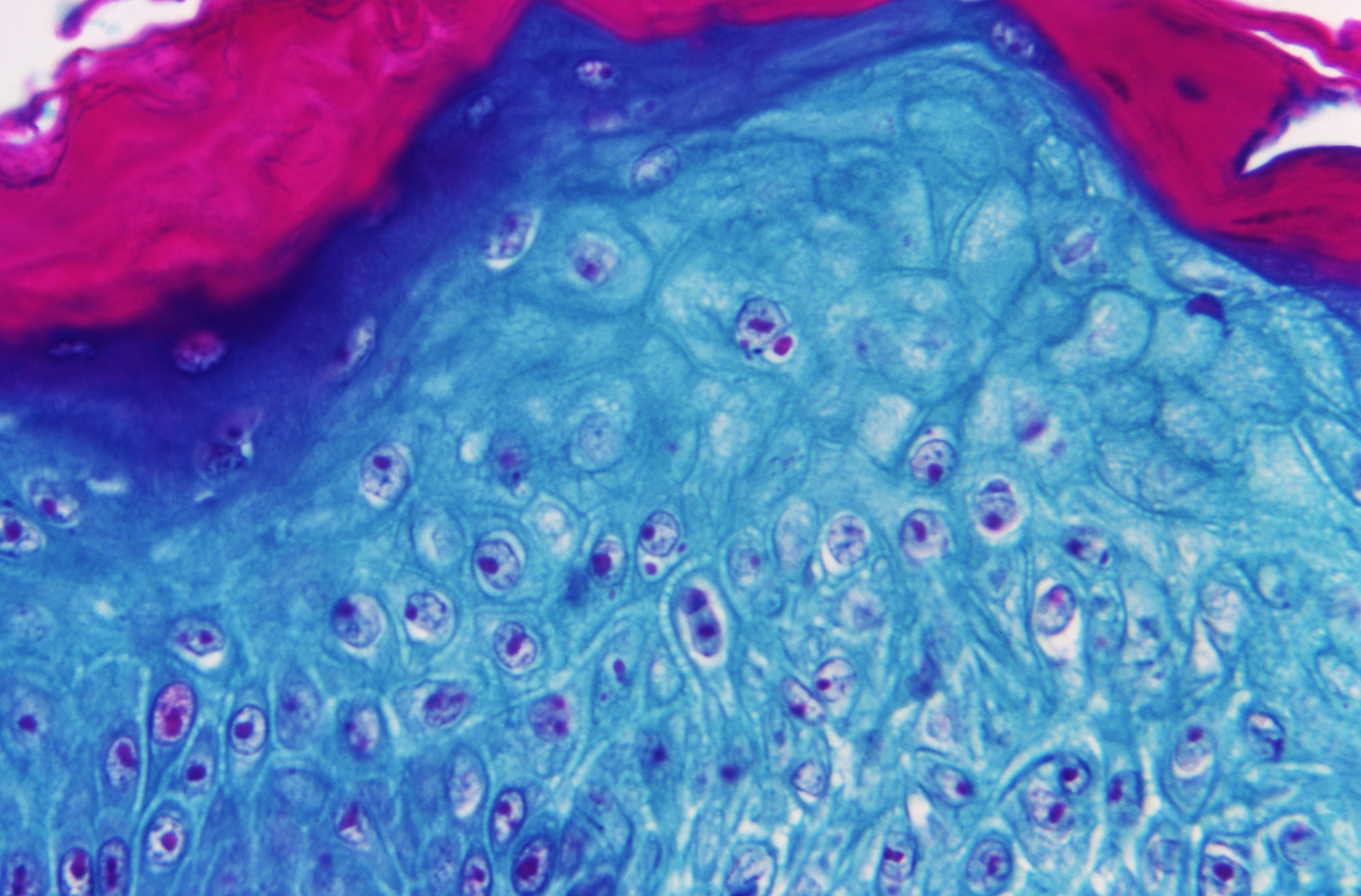Imagen ampliada con un microscopio de una muestra de piel de un mono infectado con el virus de la viruela del mono..