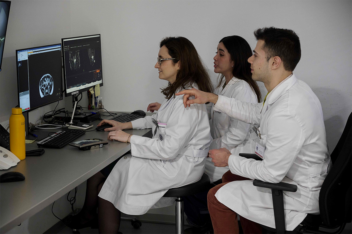 Elena Valdivielso, R2 de Oncología Radioterápica, revisa con otros miembros del equipo el tumor de un paciente que está en el acelerador Unity.