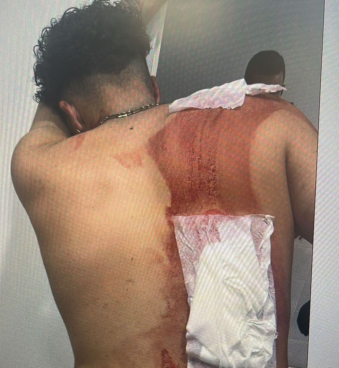 El joven herido la noche de la agresión.