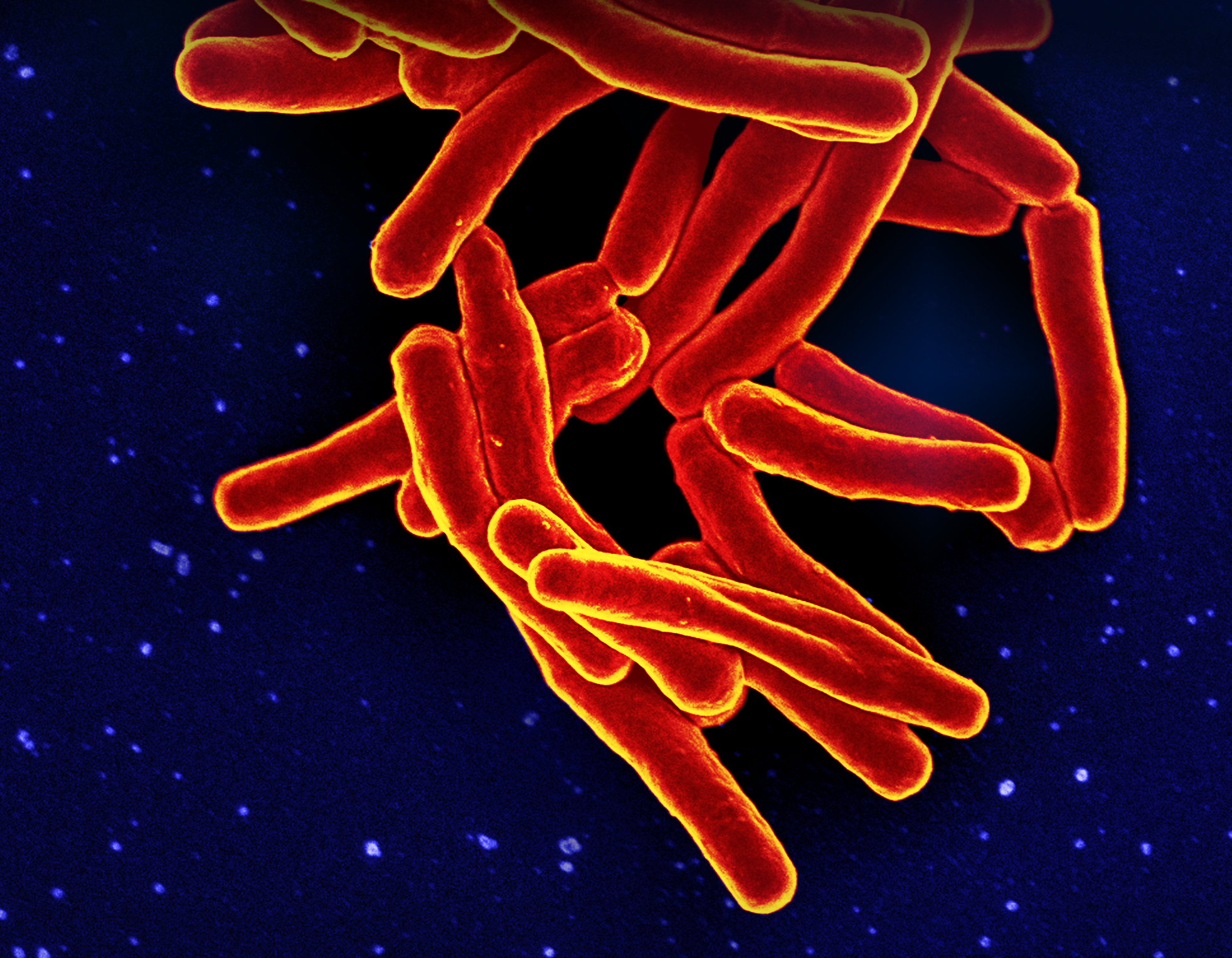 Bacterias responsables de la tuberculosis.