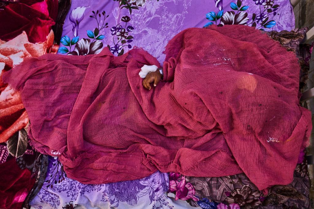 Envuelto en una tela, un niño duerme mientras recibe tratamiento en el centro de estabilización del hospital pediátrico de Port Sudan, Sudán, el miércoles 15 de abril de 2026.