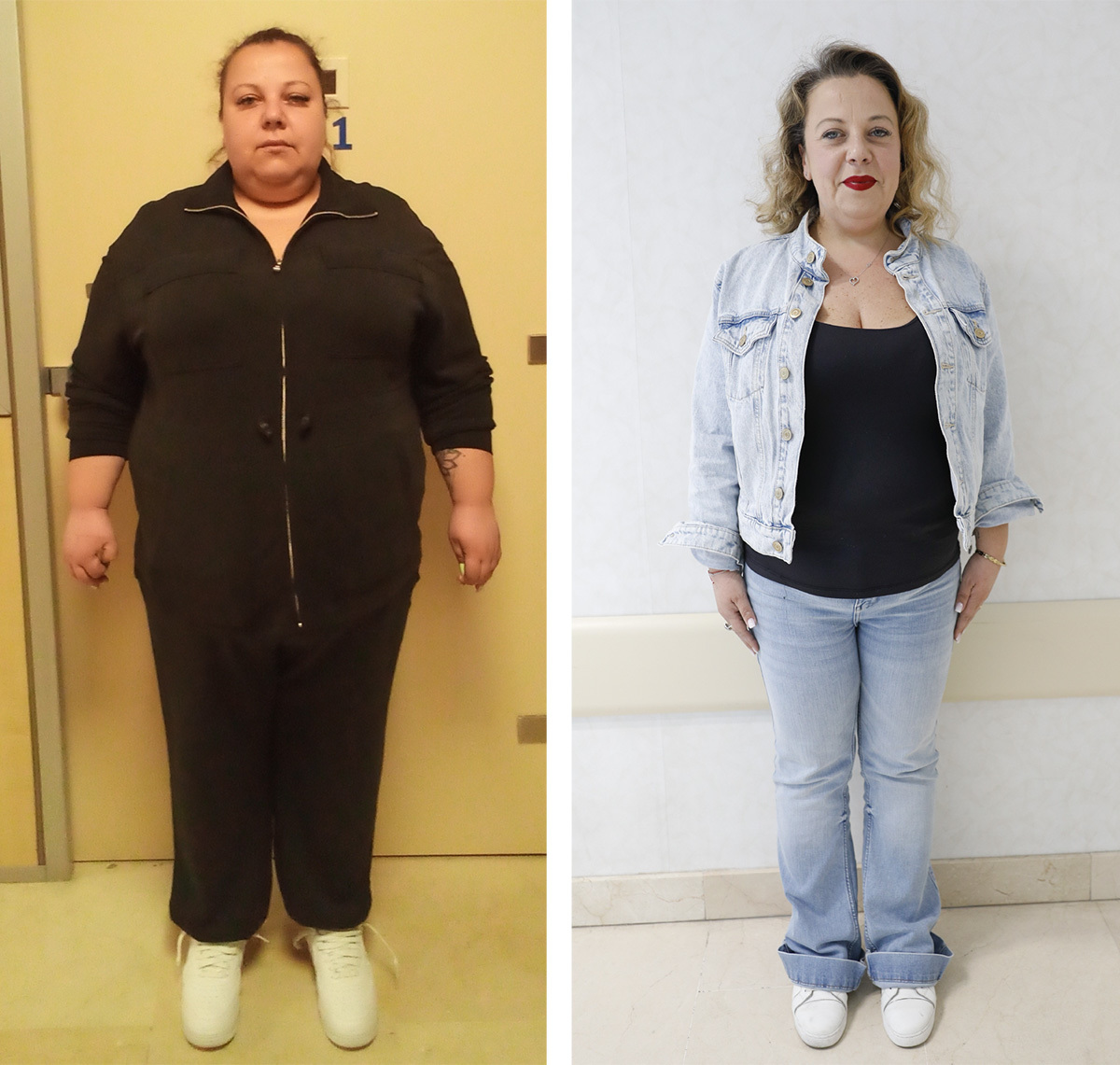 Andrada, antes y despu�s de someterse a la intervenci�n, con 50 kilos de diferencia.