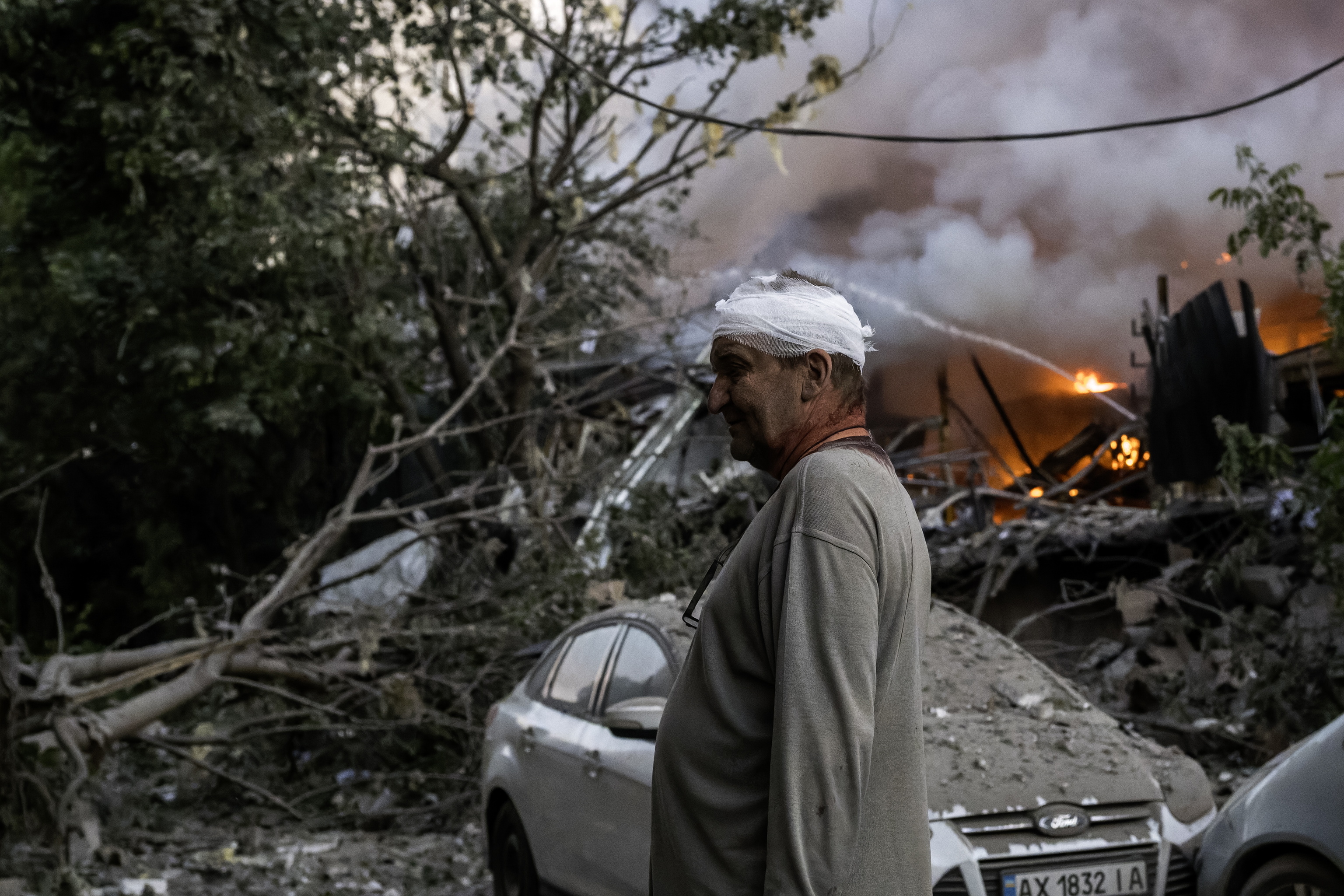 Un herido, tras el bombardeo ruso sobre Kien.