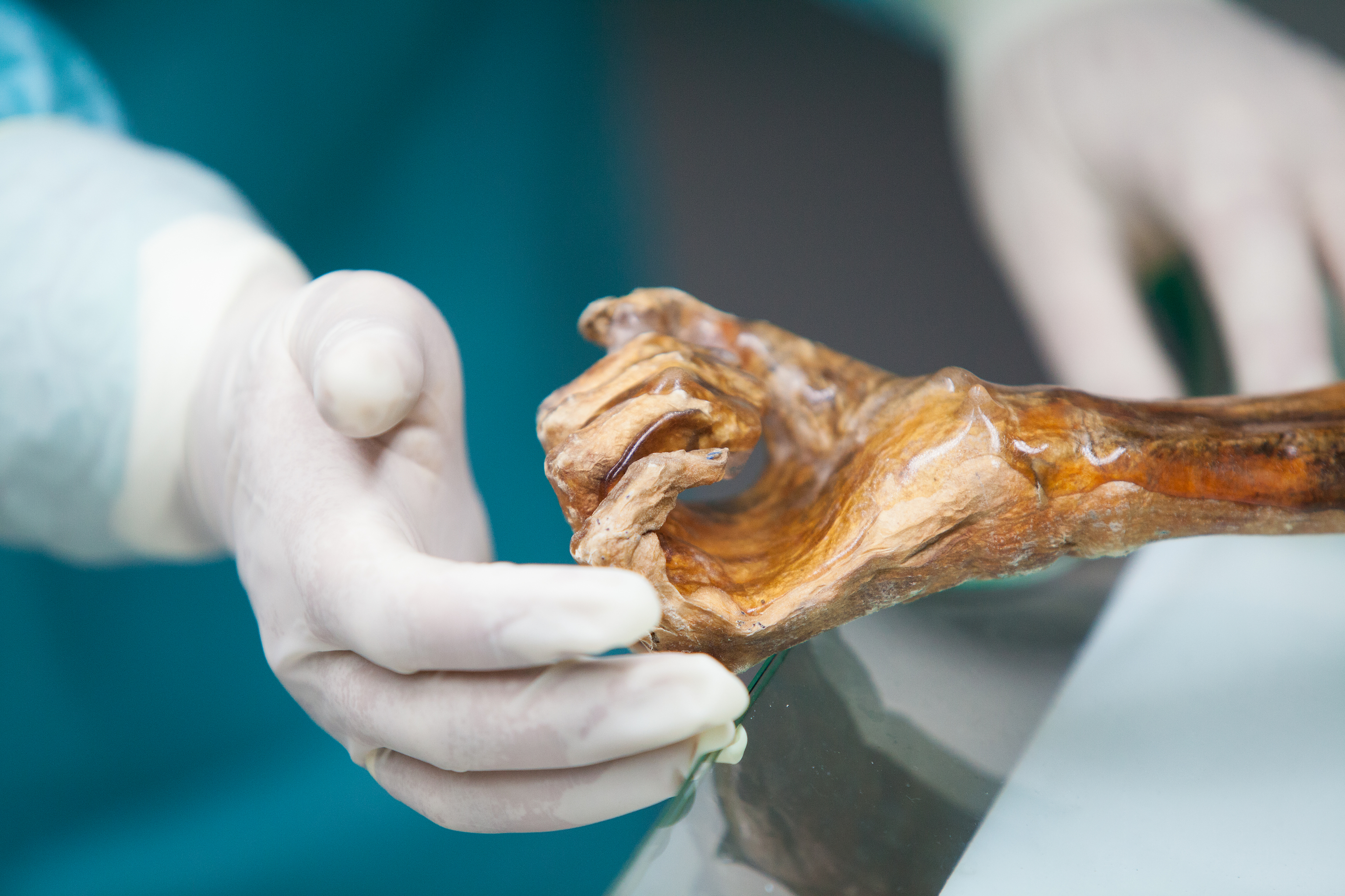 Momia de Ötzi, el hombre de hielo.