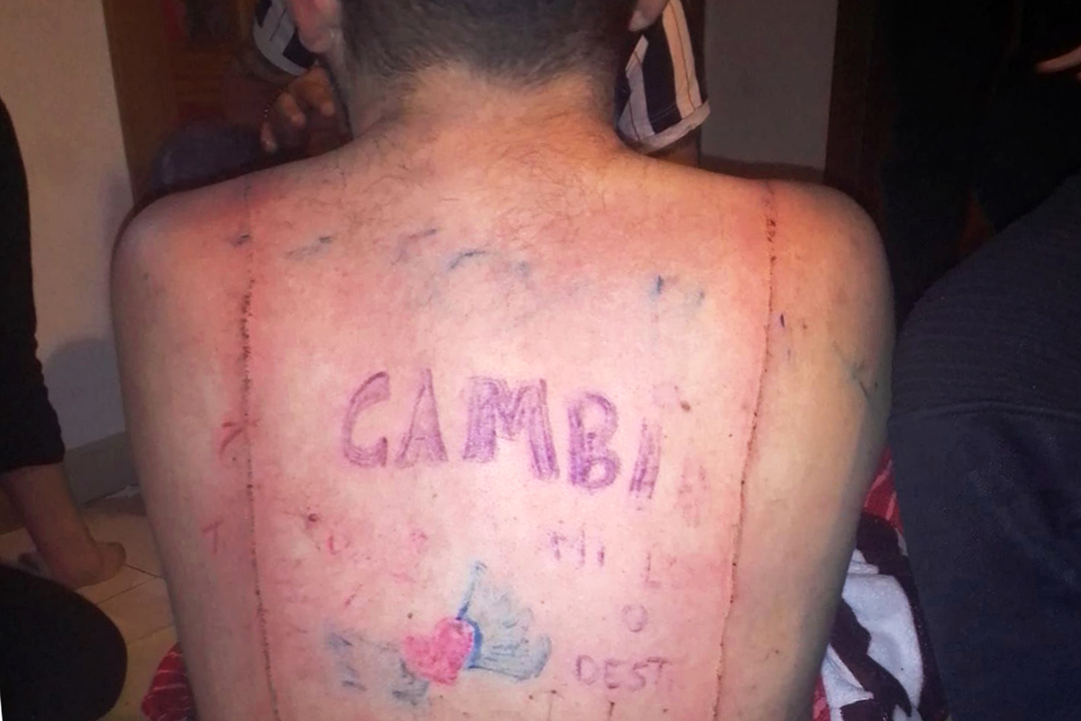 La espalda tatuada de la víctima.