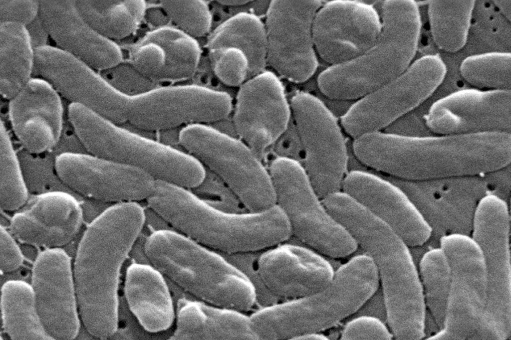 La bacteria Vibrio vulnificus, en el microscopio