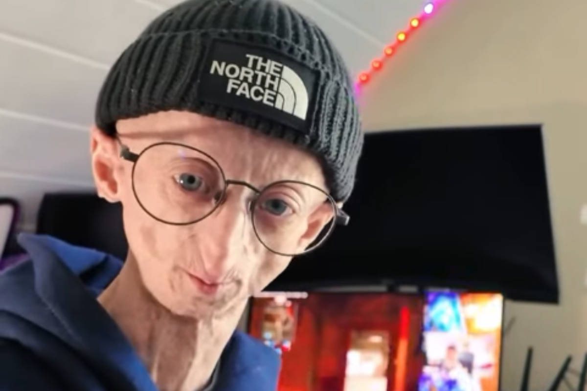 Michiel Vandeweert, conocido influencer belga con una enfermedad ultrarra