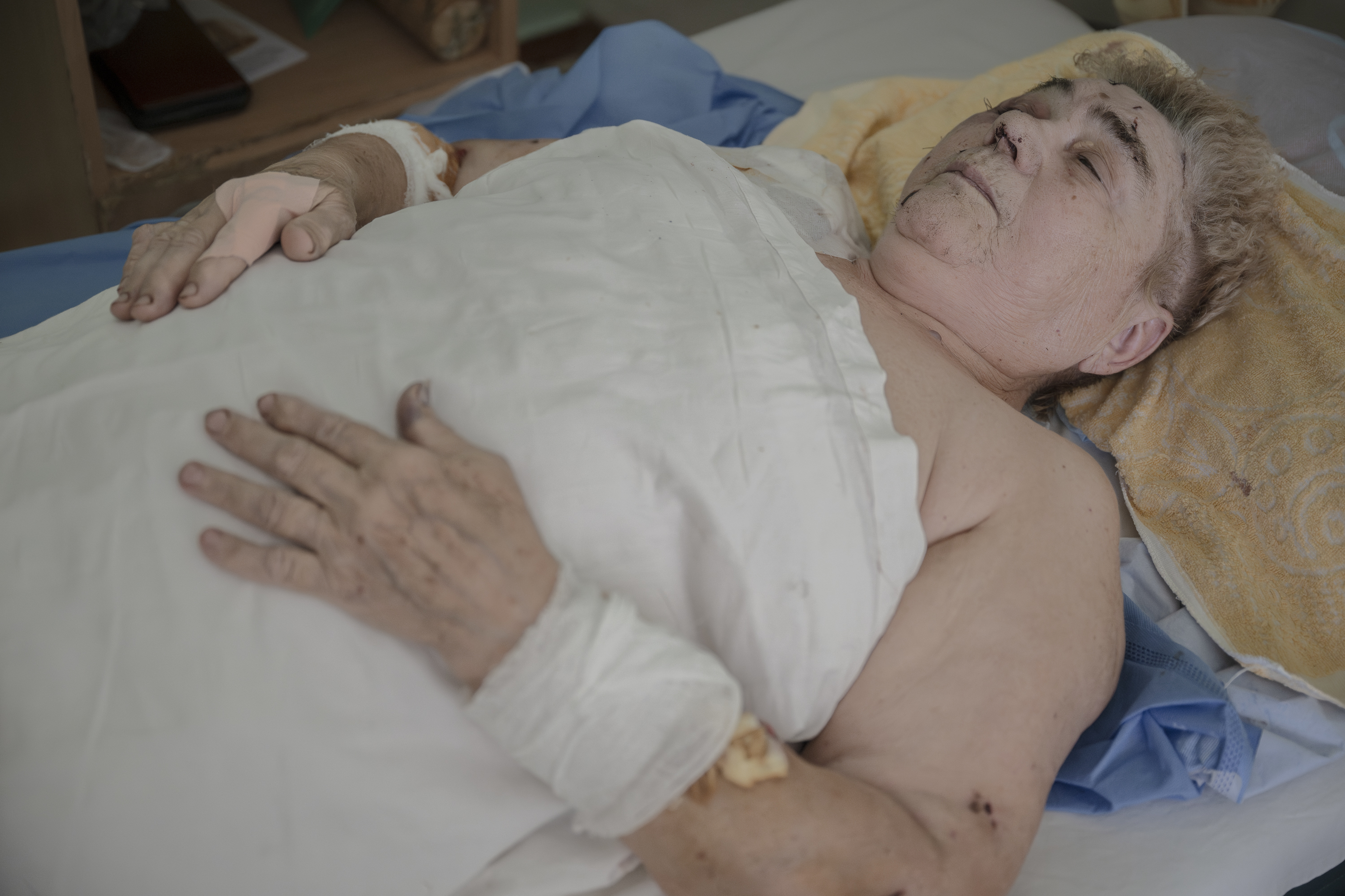 Vira, de 74 años, guarda reposa en el hospital de Jersón.
