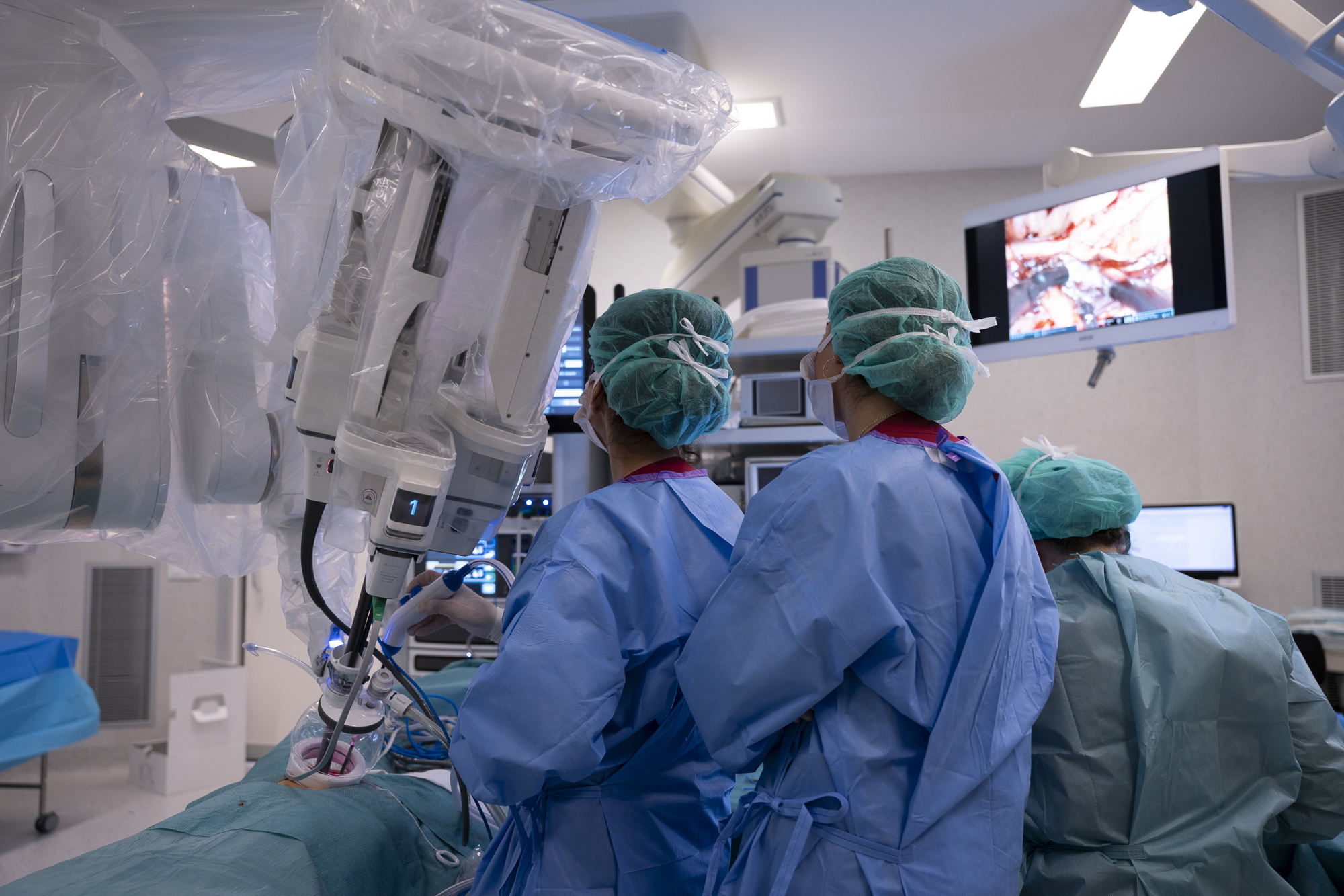 La precisión de los movimientos de los cirujanos desde la consola del robot se ve potenciada en la plataforma SP gracias a un rango de movimientos de 360 grados